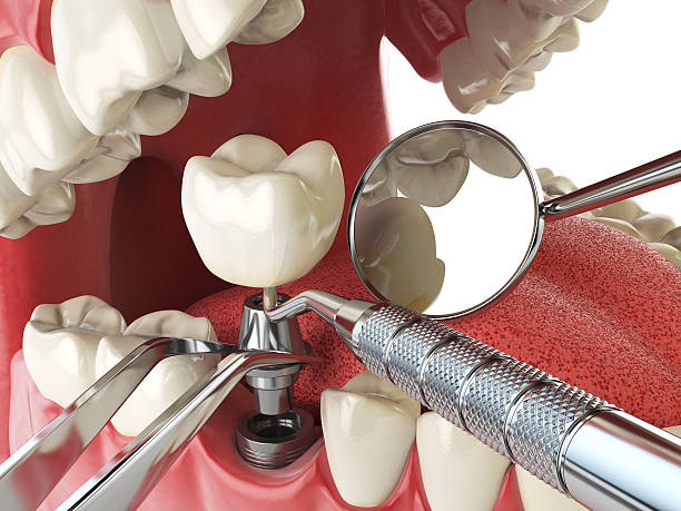 Best Pediatric Emergency Dentist in Lincolnshire, IL